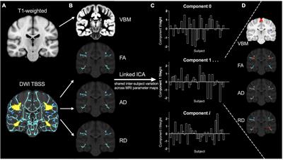 Multimodal brain features at 3 years of age and their relationship with pre-reading measures 1 year later